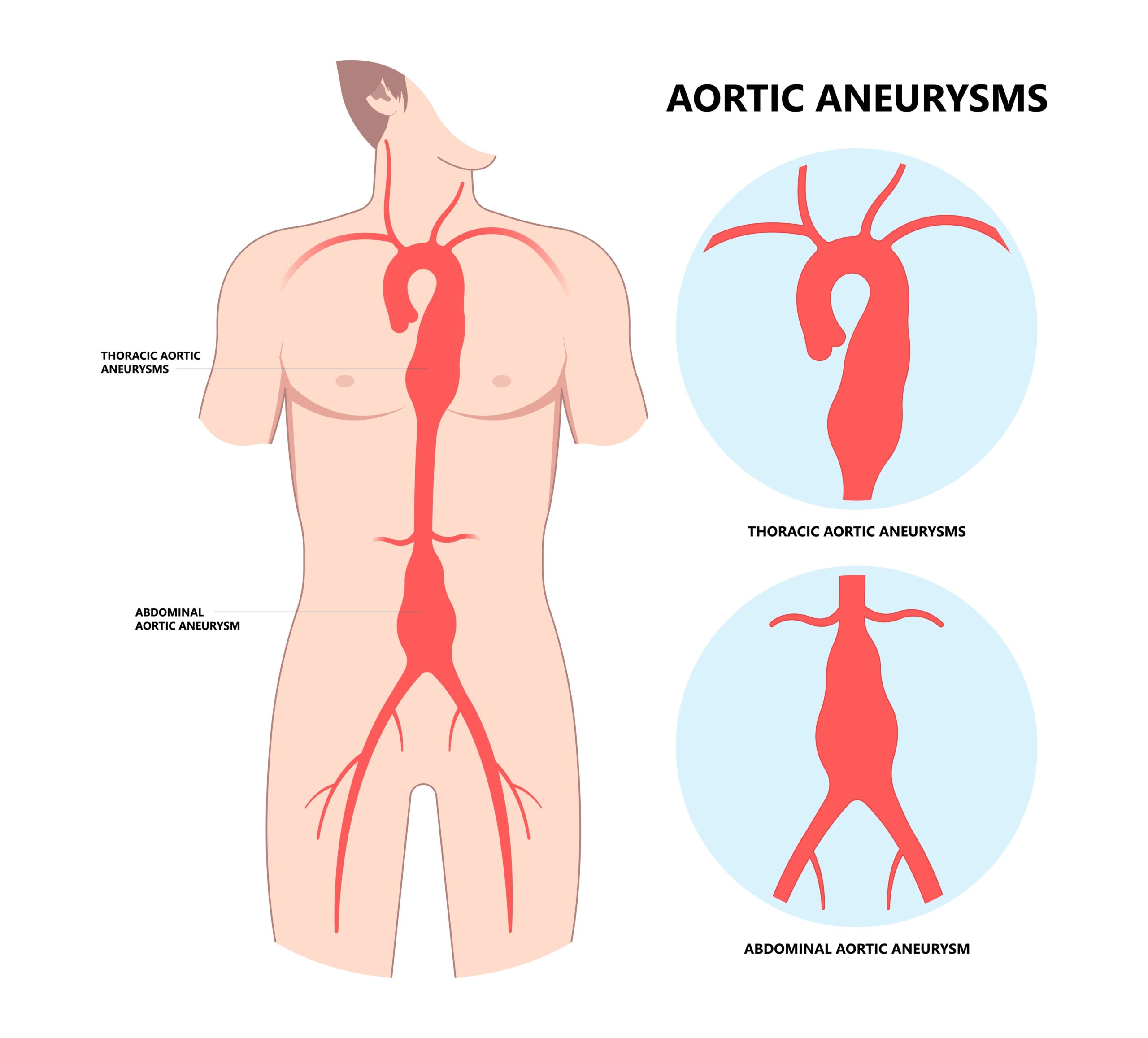 normal size of ascending aorta