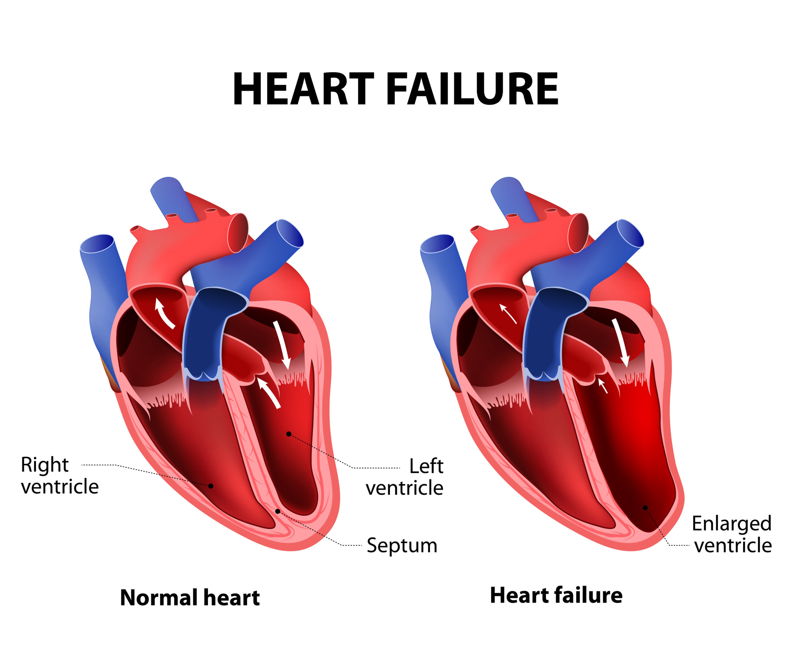Heart Failure Archives Showit Blog