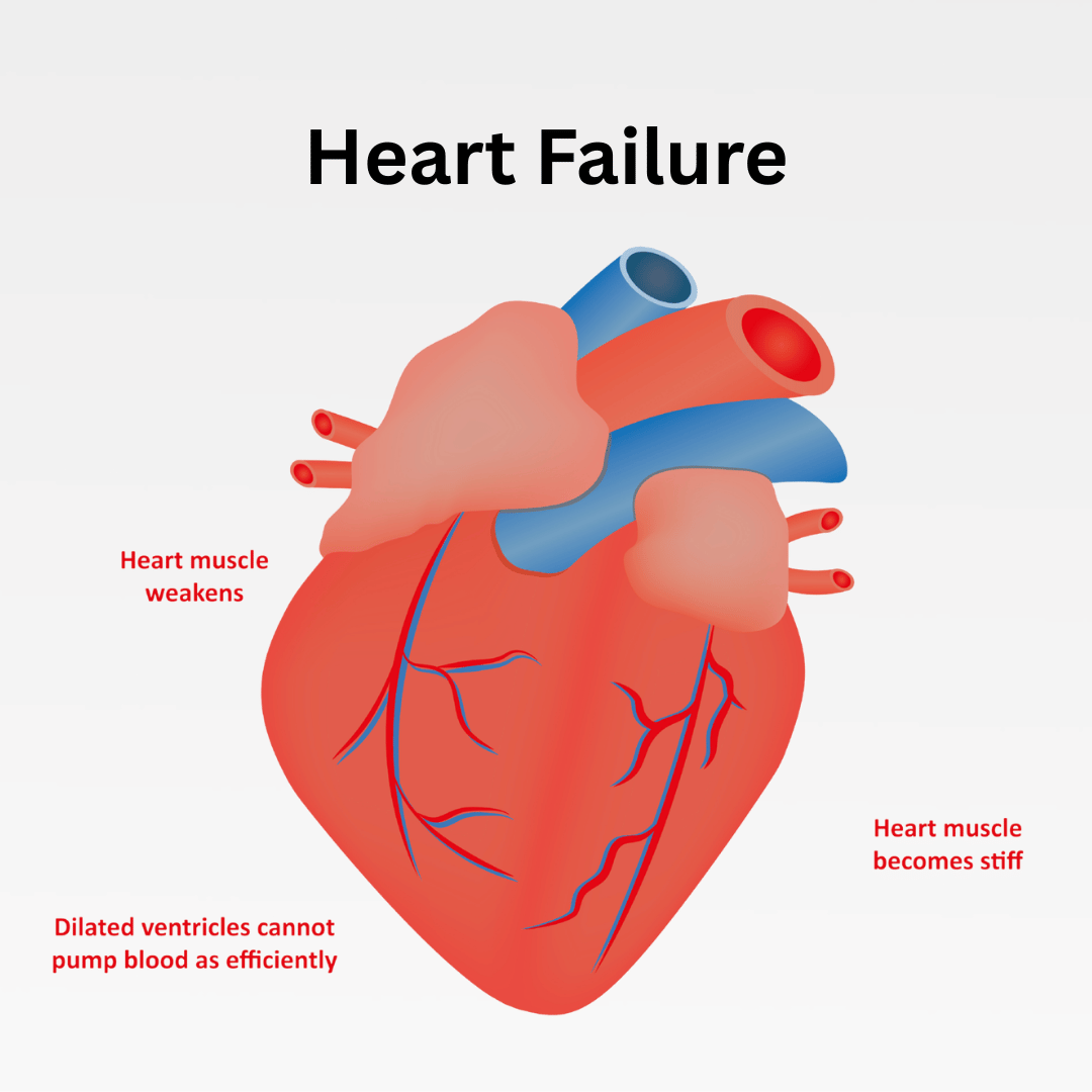 Can heart failure be reversed?