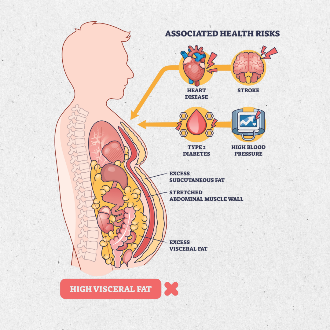 weight loss heart disease