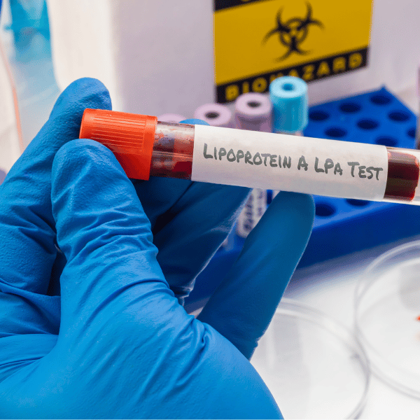 lipoprotein a test